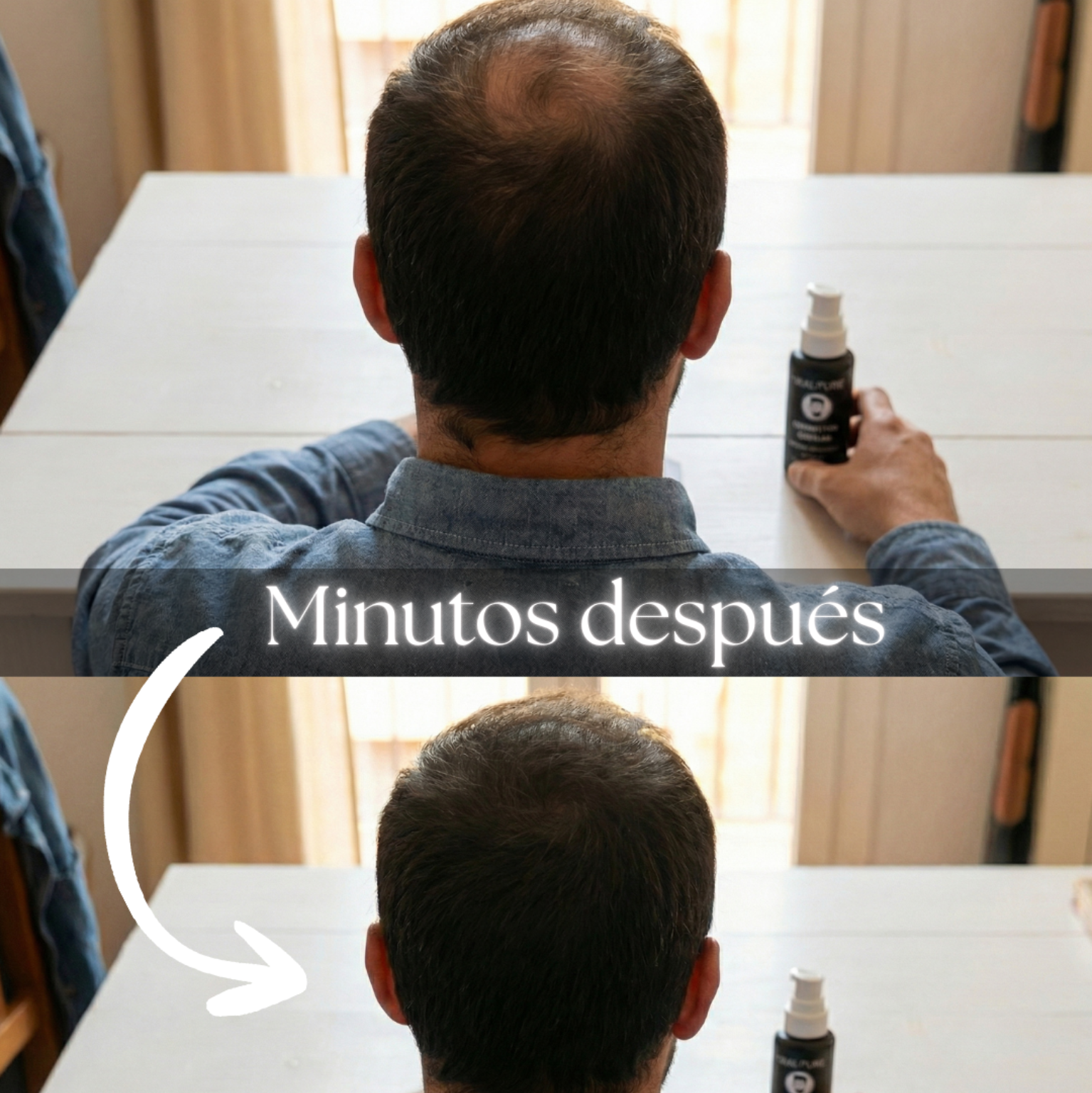 SKALPURE® – Professional Hair Concealer