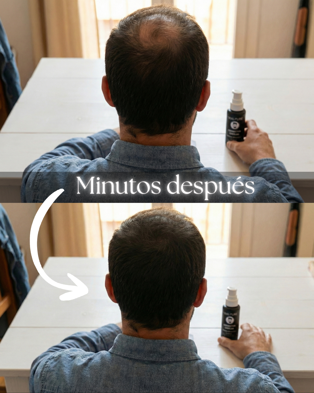 SKALPURE® – Professional Hair Concealer